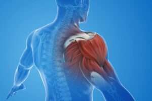 How Do I Relieve Muscle Pain