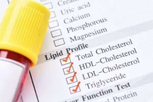lipid profile test