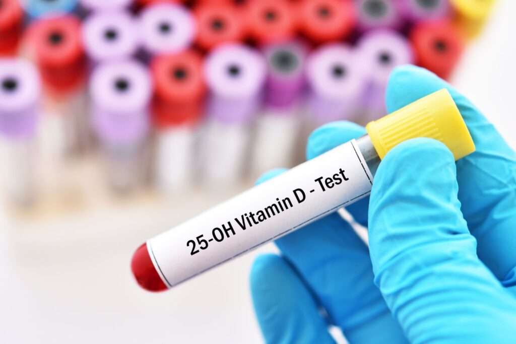 vitamin d test