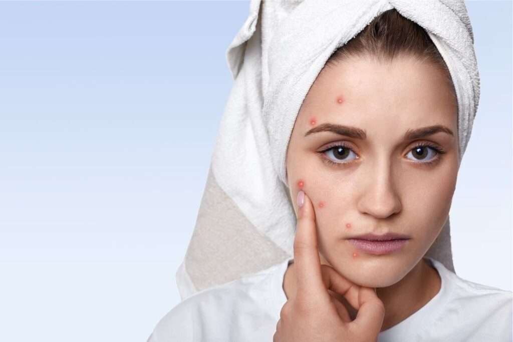 allergy signs and symptoms